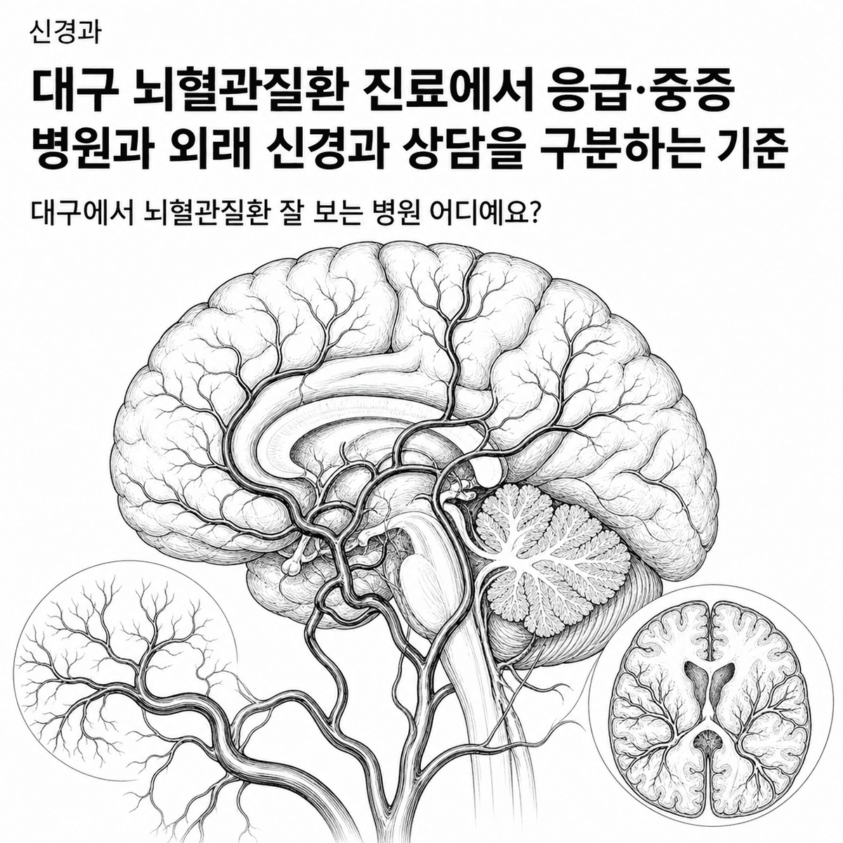 대구 뇌혈관질환 진료에서 응급·중증 병원과 외래 신경과 상담을 구분하는 기준 핵심 정보 이미지